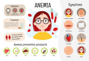anemia infantil 2 3