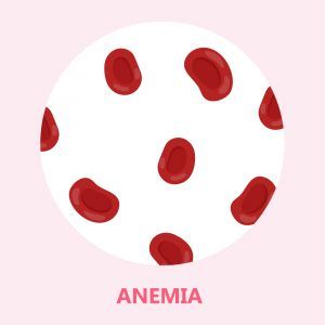 anemia infantil 3 3